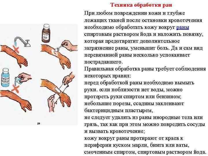 Техника обработки ран При любом повреждении кожи и глубже лежащих тканей после остановки кровотечения