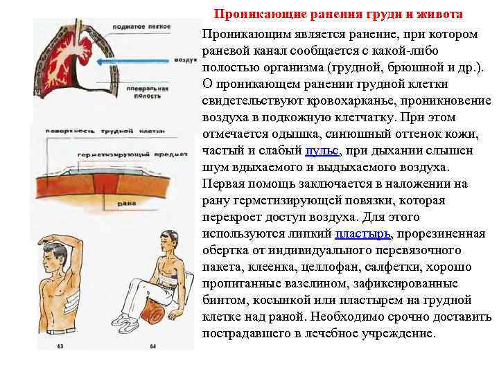 Проникающие ранения груди и живота Проникающим является ранение, при котором раневой канал сообщается с