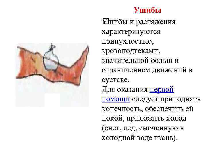 Ушибы и растяжения характеризуются припухлостью, кровоподтеками, значительной болью и ограничением движений в суставе. Для