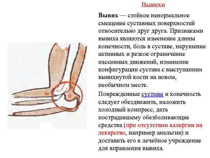 Вывихи Вывих — стойкое ненормальное смещение суставных поверхностей относительно друга. Признаками вывиха являются изменение