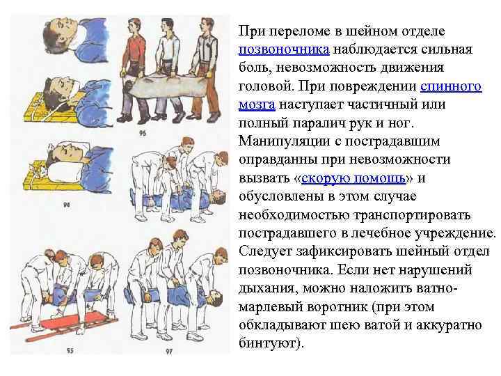 При переломе в шейном отделе позвоночника наблюдается сильная боль, невозможность движения головой. При повреждении