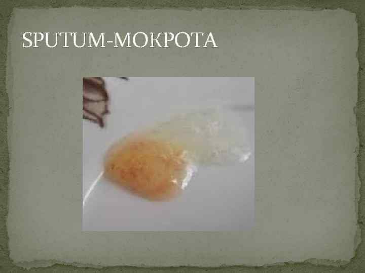 SPUTUM-МОКРОТА 