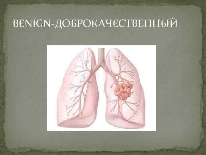BENIGN-ДОБРОКАЧЕСТВЕННЫЙ 