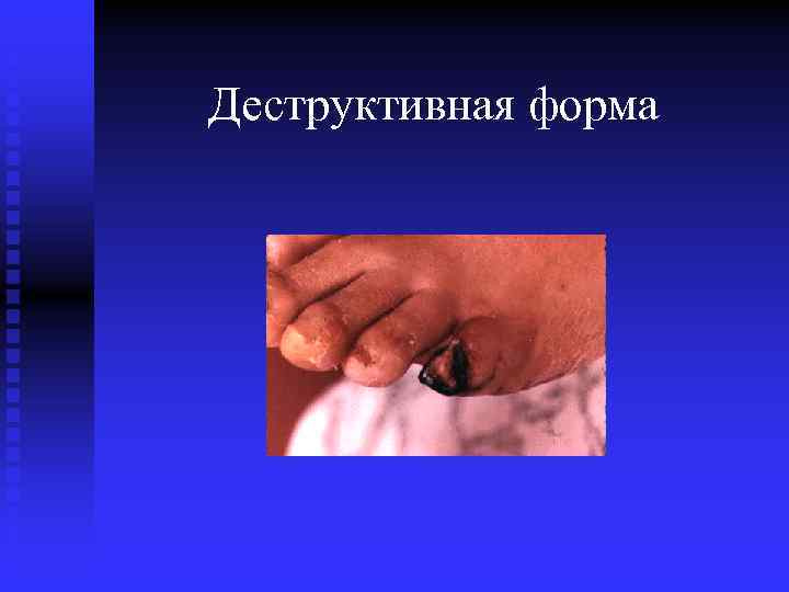 Деструктивная форма 