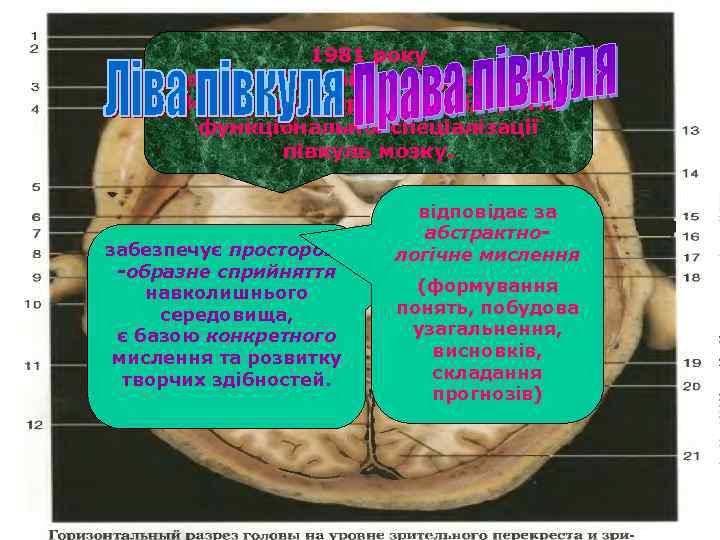 1981 року Роджеру Сперрі була присуджена Нобелевська премія за відкриття функціональної спеціалізації півкуль мозку.