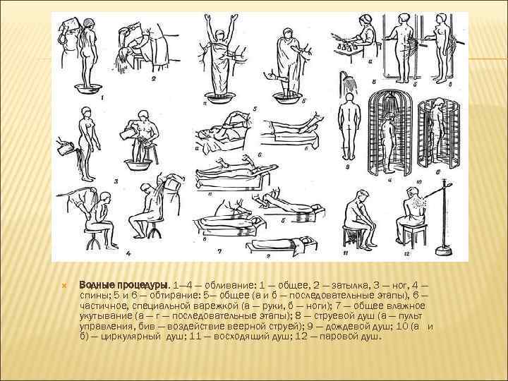  Водные процедуры. 1— 4 — обливание: 1 — общее, 2 — затылка, 3