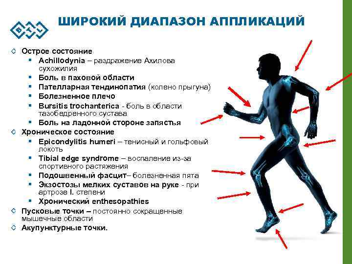 ШИРОКИЙ ДИАПАЗОН АППЛИКАЦИЙ Острое состояние § Achillodynia – раздражение Ахилова сухожилия § Боль в