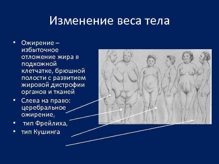 Изменение веса тела • Ожирение – избыточное отложение жира в подкожной клетчатке, брюшной полости
