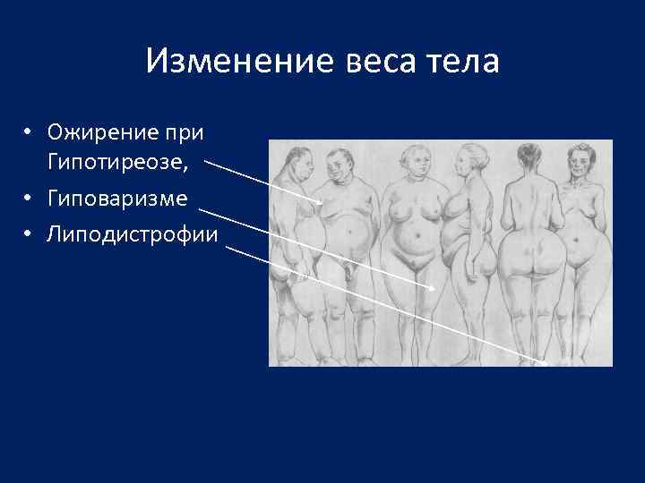 Изменение веса тела • Ожирение при Гипотиреозе, • Гиповаризме • Липодистрофии 