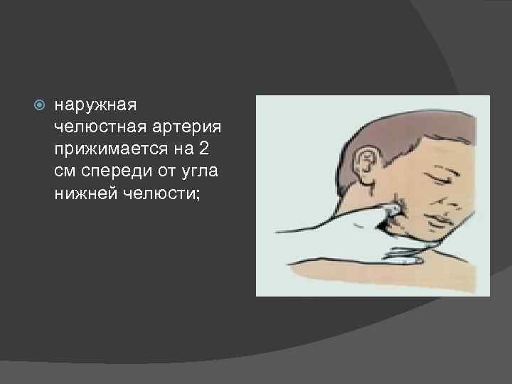  наружная челюстная артерия прижимается на 2 см спереди от угла нижней челюсти; 