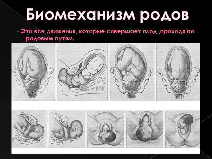 Биомеханизм родов - Это все движения, которые совершает плод , проходя по родовым путям.