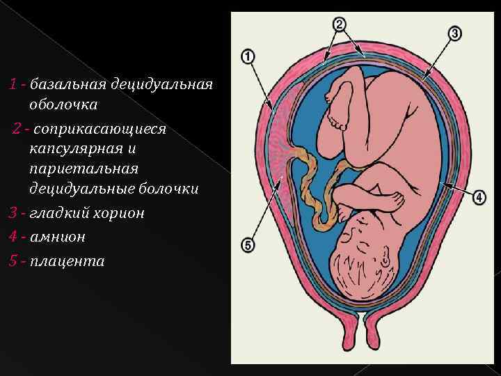 1 - базальная децидуальная оболочка 2 - соприкасающиеся капсулярная и париетальная децидуальные болочки 3