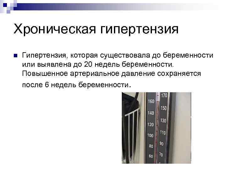 Хроническая гипертензия n Гипертензия, которая существовала до беременности или выявлена до 20 недель беременности.