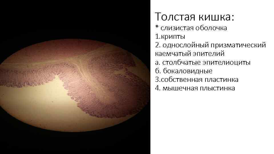 Толстая кишка: * слизистая оболочка 1. крипты 2. однослойный призматический каемчатый эпителий а. столбчатые