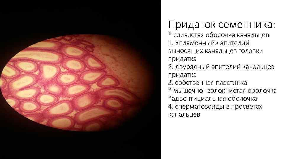 Придаток семенника: * слизистая оболочка канальцев 1. «пламенный» эпителий выносящих канальцев головки придатка 2.