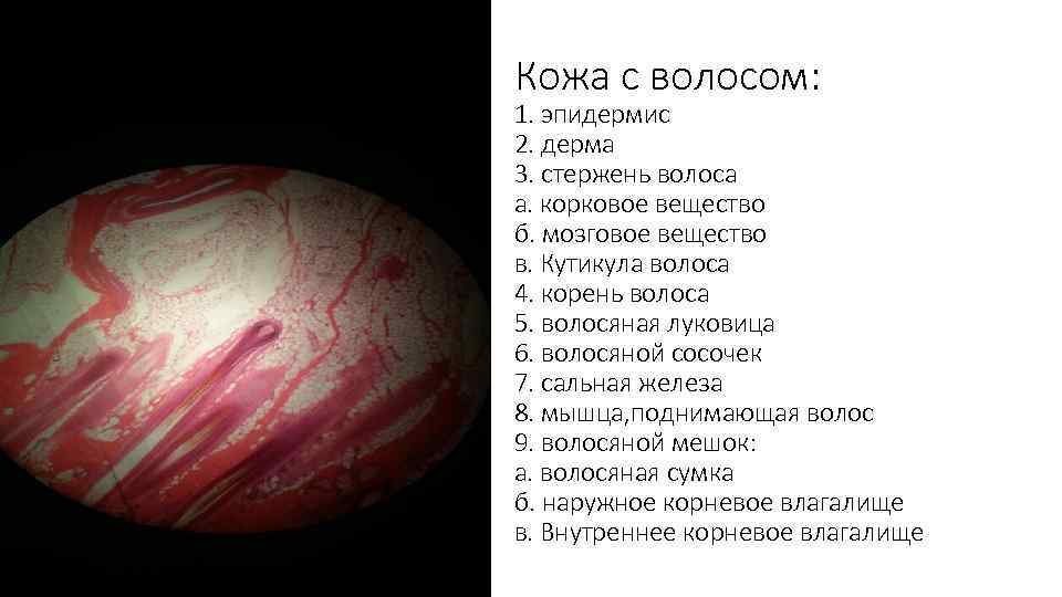 Кожа с волосом: 1. эпидермис 2. дерма 3. стержень волоса а. корковое вещество б.