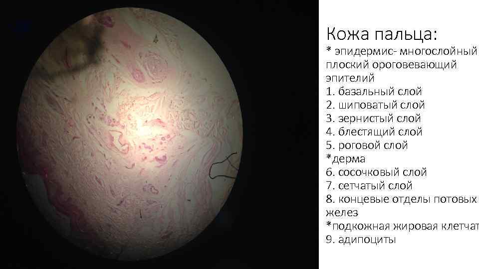 Кожа пальца: * эпидермис- многослойный плоский ороговевающий эпителий 1. базальный слой 2. шиповатый слой