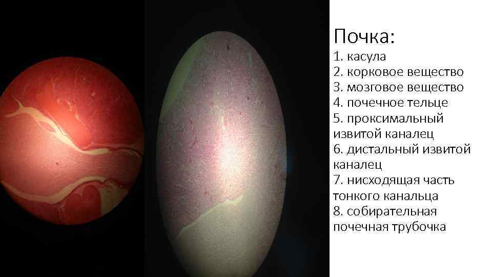 Почка: 1. касула 2. корковое вещество 3. мозговое вещество 4. почечное тельце 5. проксимальный
