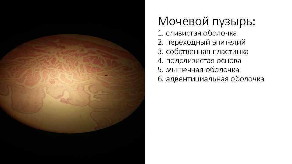 Адвентициальная оболочка мочевого пузыря. Адвентициальная оболочка. Тох1 оболочка.