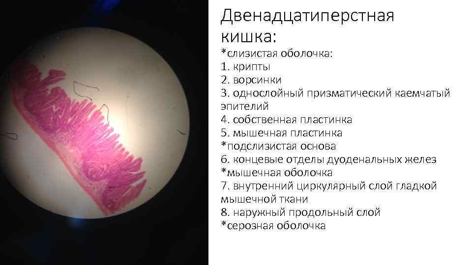 Двенадцатиперстная кишка: *слизистая оболочка: 1. крипты 2. ворсинки 3. однослойный призматический каемчатый эпителий 4.