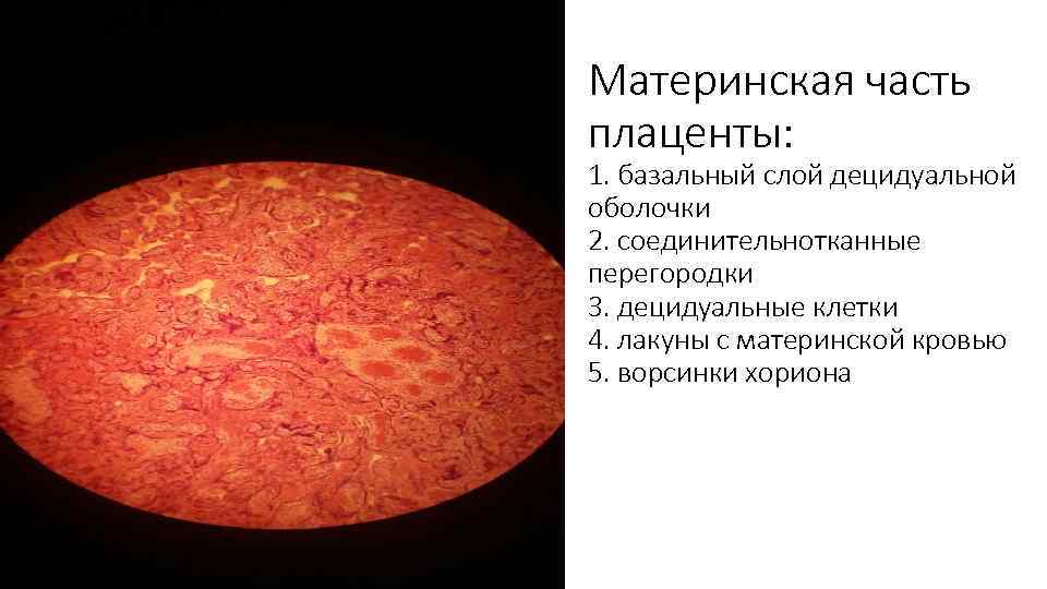 Материнская часть плаценты: 1. базальный слой децидуальной оболочки 2. соединительнотканные перегородки 3. децидуальные клетки