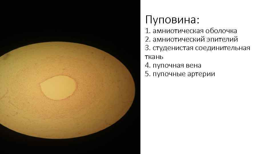 Пуповина: 1. амниотическая оболочка 2. амниотический эпителий 3. студенистая соединительная ткань 4. пупочная вена