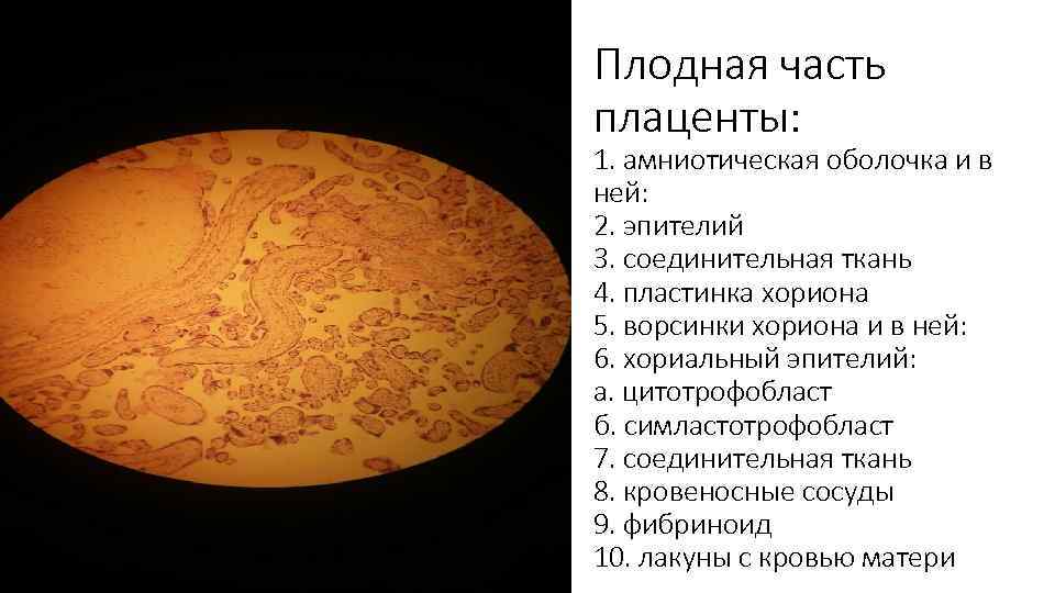 Плодная часть плаценты: 1. амниотическая оболочка и в ней: 2. эпителий 3. соединительная ткань