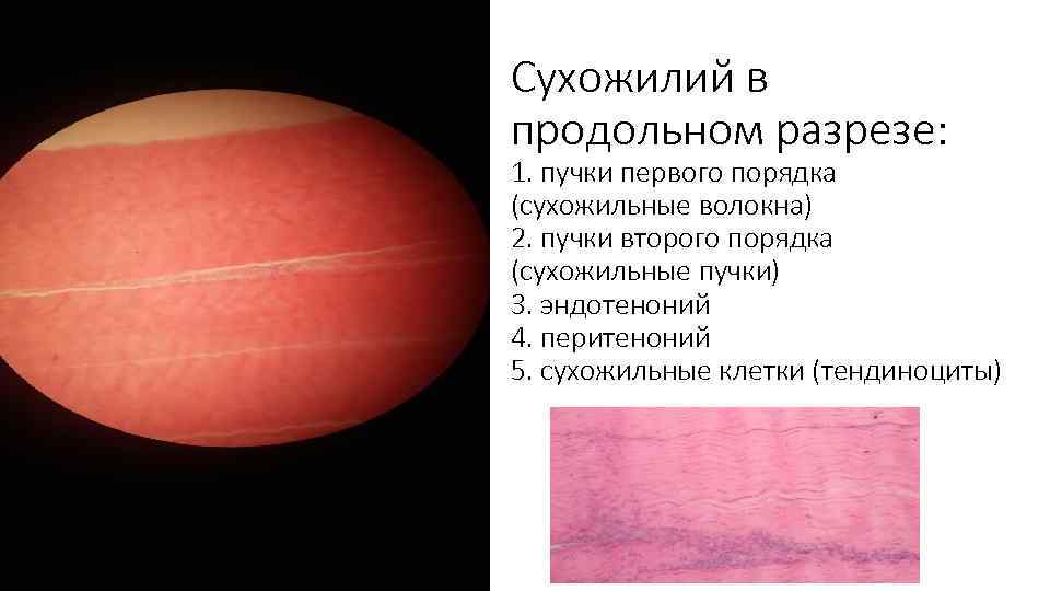 Сухожилий в продольном разрезе: 1. пучки первого порядка (сухожильные волокна) 2. пучки второго порядка