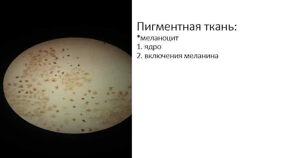 Пигментная ткань: *меланоцит 1. ядро 2. включения меланина 