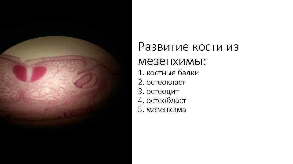 Развитие кости из мезенхимы: 1. костные балки 2. остеокласт 3. остеоцит 4. остеобласт 5.