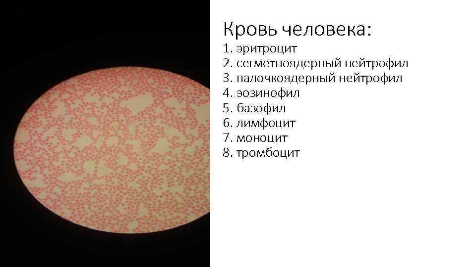 Кровь человека: 1. эритроцит 2. сегметноядерный нейтрофил 3. палочкоядерный нейтрофил 4. эозинофил 5. базофил