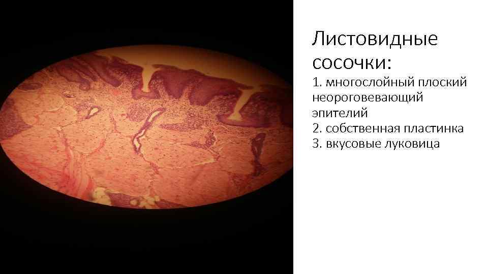 Листовидные сосочки: 1. многослойный плоский неороговевающий эпителий 2. собственная пластинка 3. вкусовые луковица 