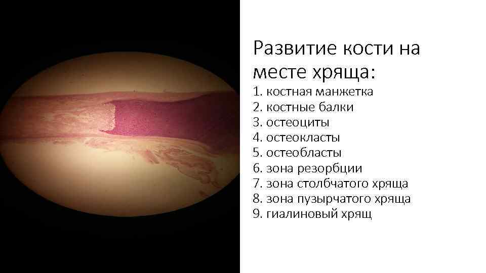Развитие кости на месте хряща: 1. костная манжетка 2. костные балки 3. остеоциты 4.