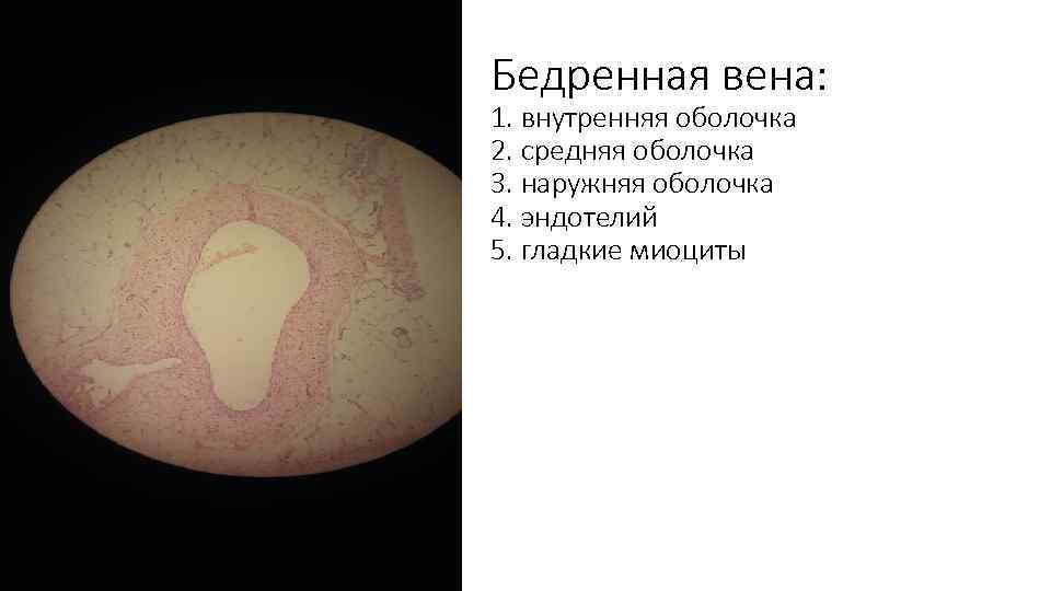 Бедренная вена: 1. внутренняя оболочка 2. средняя оболочка 3. наружняя оболочка 4. эндотелий 5.