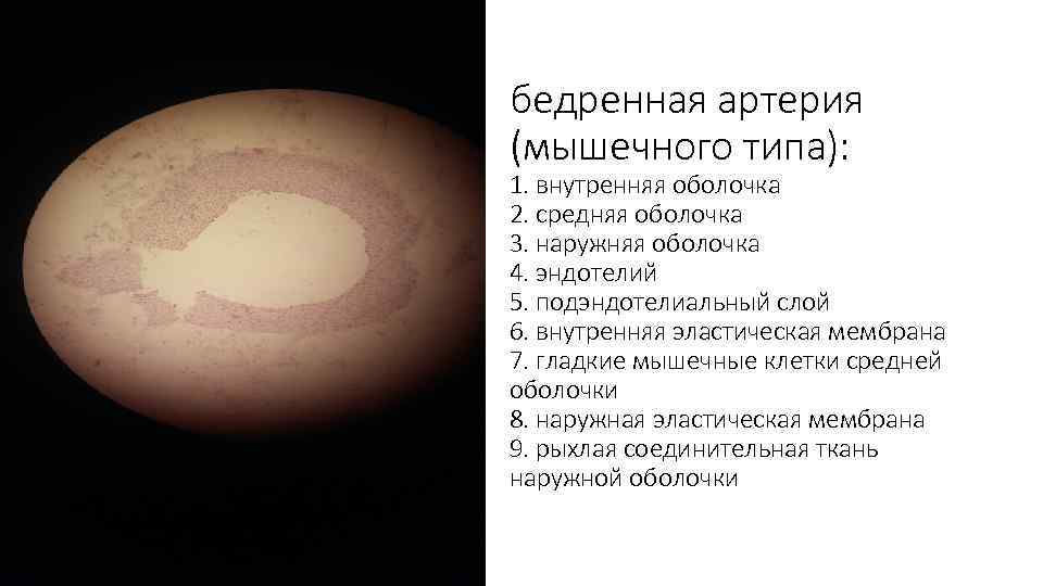 бедренная артерия (мышечного типа): 1. внутренняя оболочка 2. средняя оболочка 3. наружняя оболочка 4.