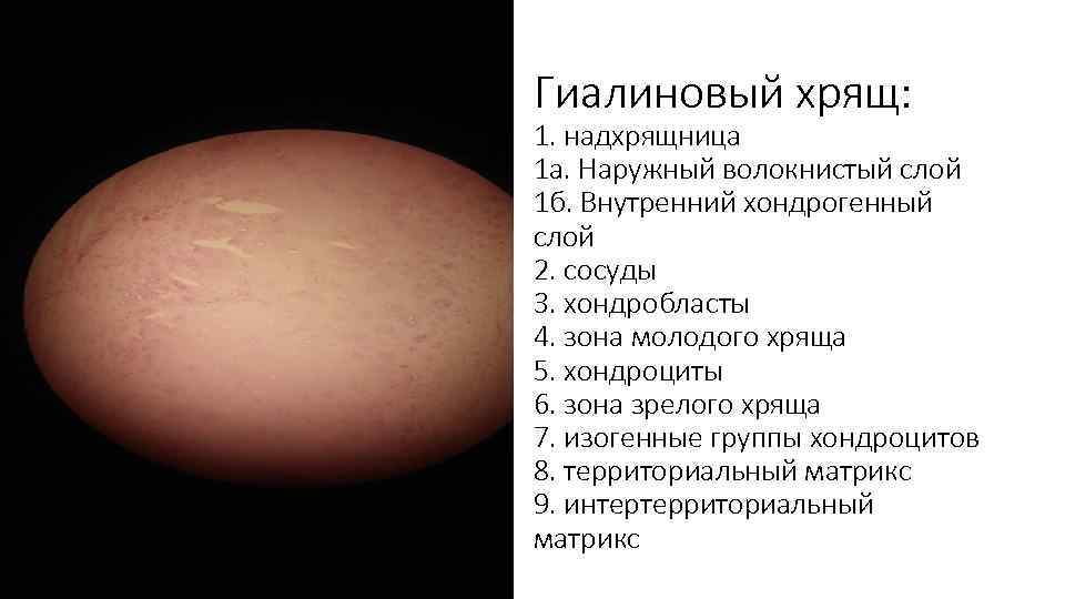 Гиалиновый хрящ: 1. надхрящница 1 а. Наружный волокнистый слой 1 б. Внутренний хондрогенный слой