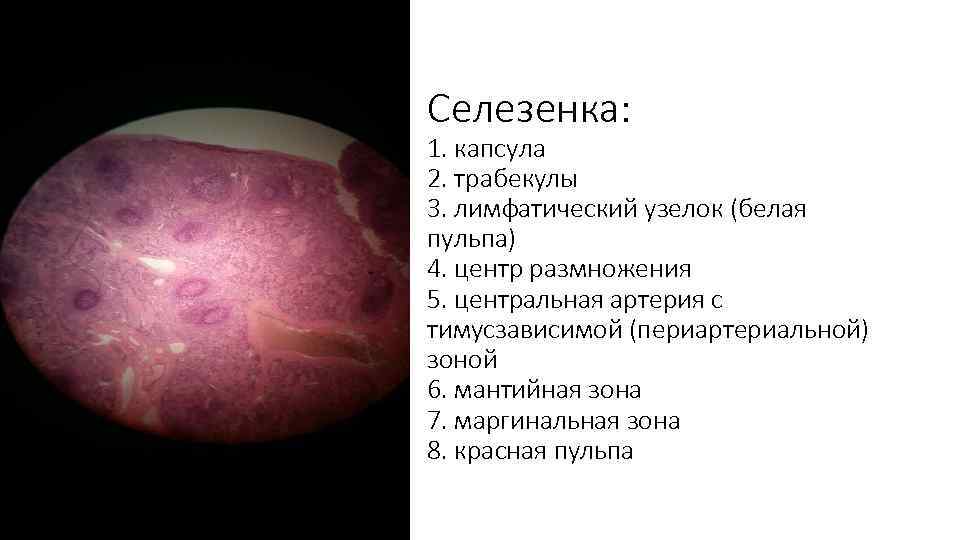 Селезенка: 1. капсула 2. трабекулы 3. лимфатический узелок (белая пульпа) 4. центр размножения 5.