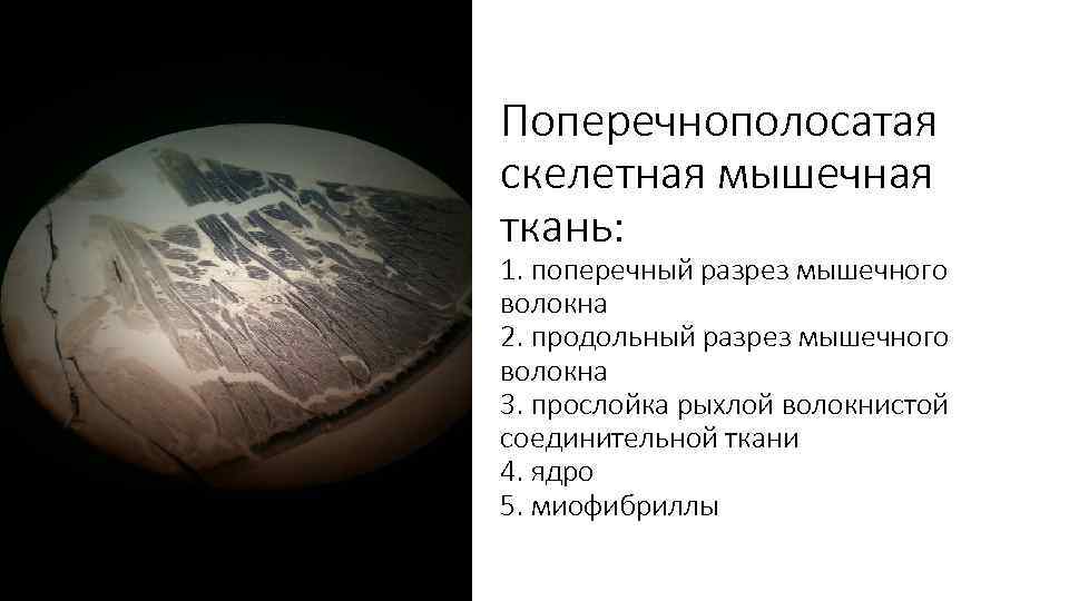 Поперечнополосатая скелетная мышечная ткань: 1. поперечный разрез мышечного волокна 2. продольный разрез мышечного волокна