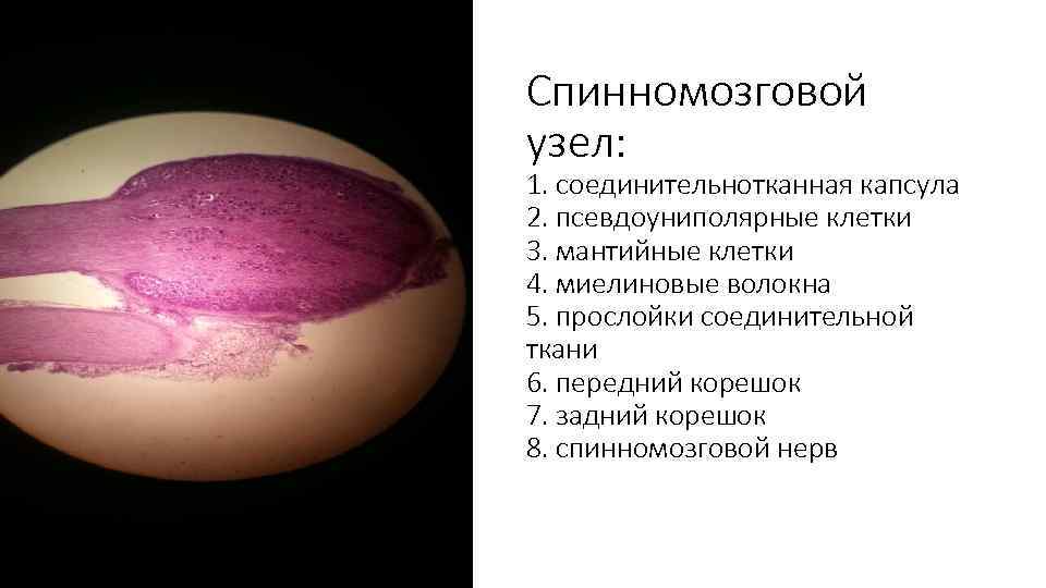 Спинномозговой узел: 1. соединительнотканная капсула 2. псевдоуниполярные клетки 3. мантийные клетки 4. миелиновые волокна