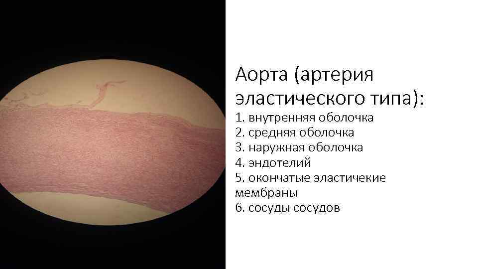 Аорта (артерия эластического типа): 1. внутренняя оболочка 2. средняя оболочка 3. наружная оболочка 4.