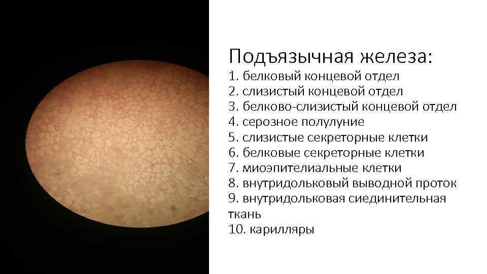 Подъязычная железа: 1. белковый концевой отдел 2. слизистый концевой отдел 3. белково-слизистый концевой отдел