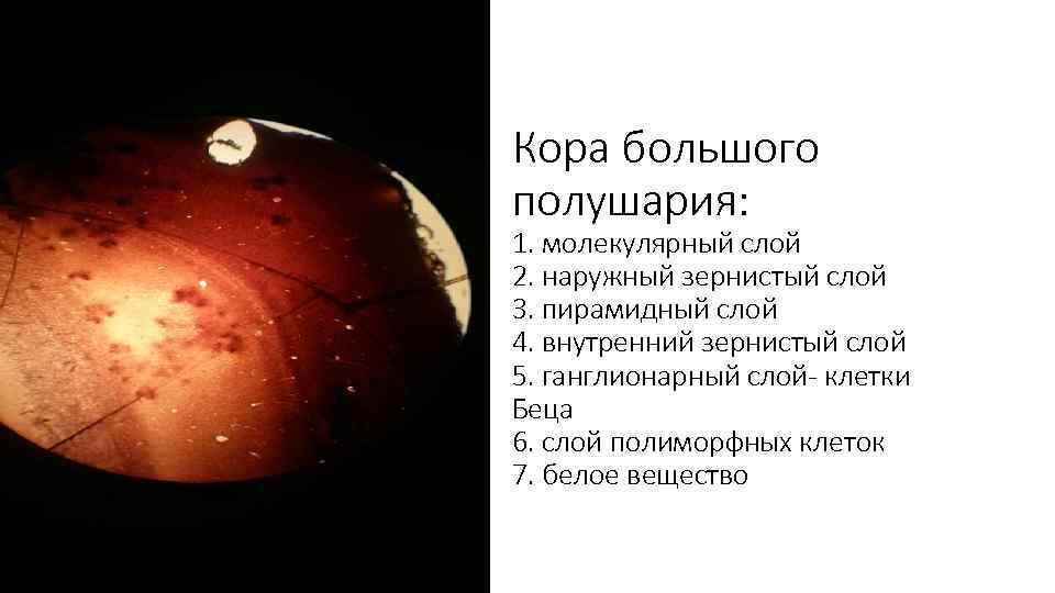 Кора большого полушария: 1. молекулярный слой 2. наружный зернистый слой 3. пирамидный слой 4.