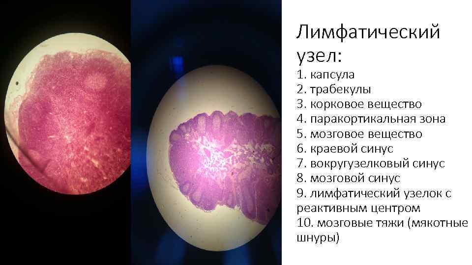 Лимфатический узел: 1. капсула 2. трабекулы 3. корковое вещество 4. паракортикальная зона 5. мозговое