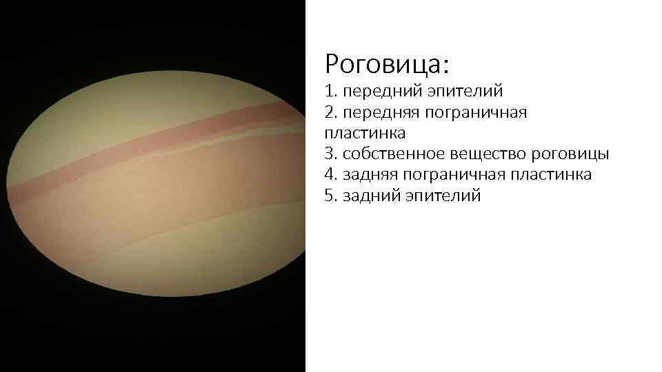 Роговица: 1. передний эпителий 2. передняя пограничная пластинка 3. собственное вещество роговицы 4. задняя