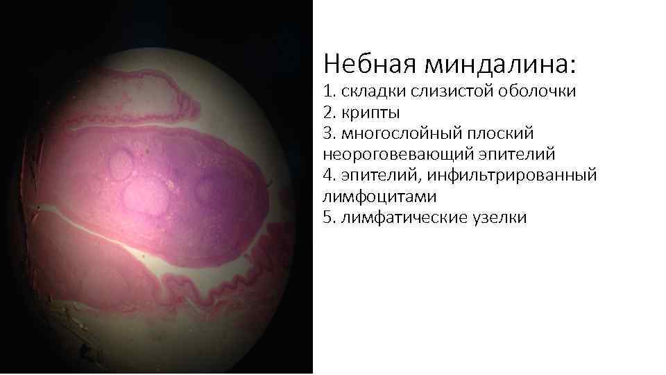Небная миндалина: 1. складки слизистой оболочки 2. крипты 3. многослойный плоский неороговевающий эпителий 4.
