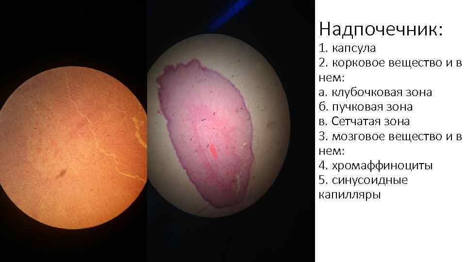 Надпочечник: 1. капсула 2. корковое вещество и в нем: а. клубочковая зона б. пучковая