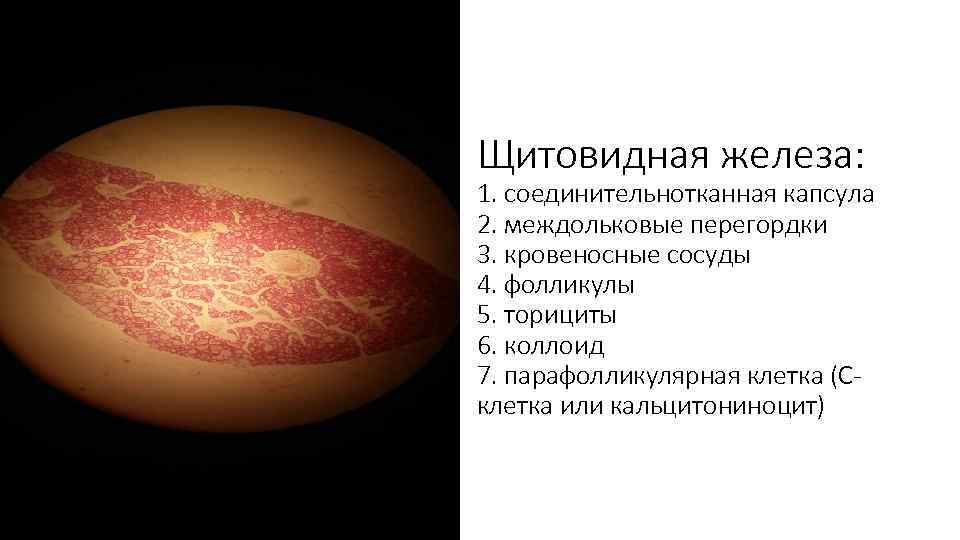 Щитовидная железа: 1. соединительнотканная капсула 2. междольковые перегордки 3. кровеносные сосуды 4. фолликулы 5.