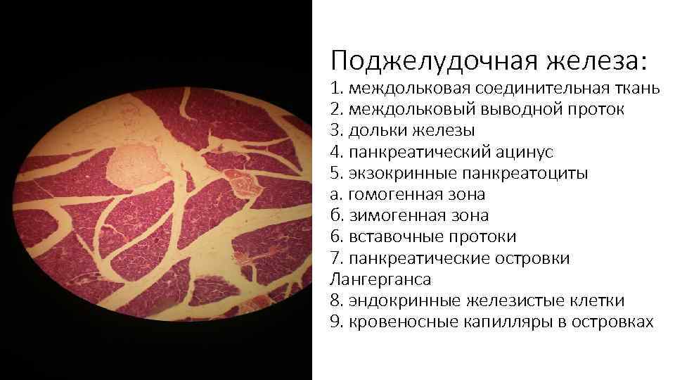 Поджелудочная железа: 1. междольковая соединительная ткань 2. междольковый выводной проток 3. дольки железы 4.