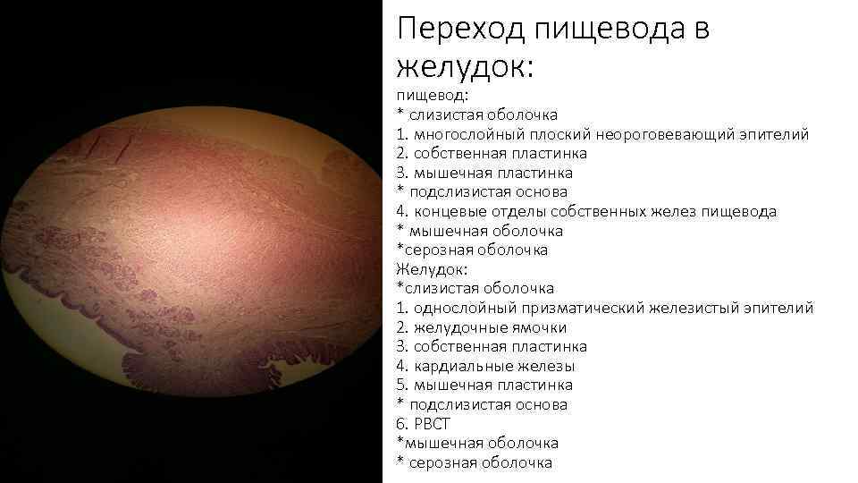 Переход пищевода в желудок: пищевод: * слизистая оболочка 1. многослойный плоский неороговевающий эпителий 2.