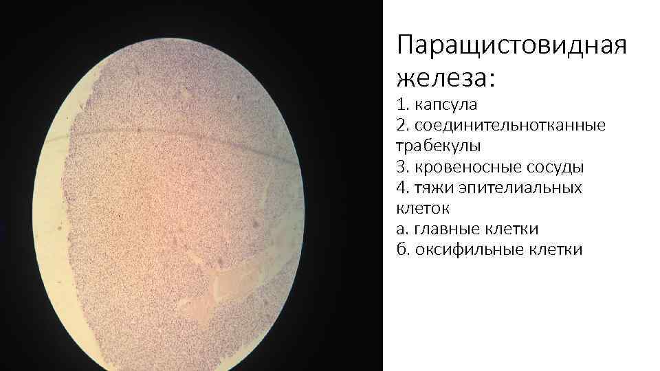 Паращистовидная железа: 1. капсула 2. соединительнотканные трабекулы 3. кровеносные сосуды 4. тяжи эпителиальных клеток